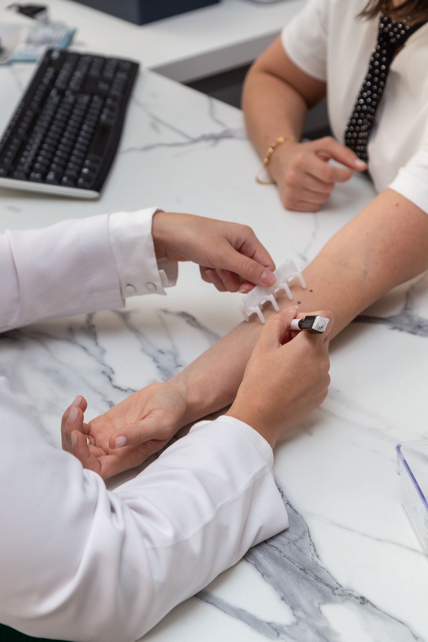 Prick-test sendo realizado no consultório